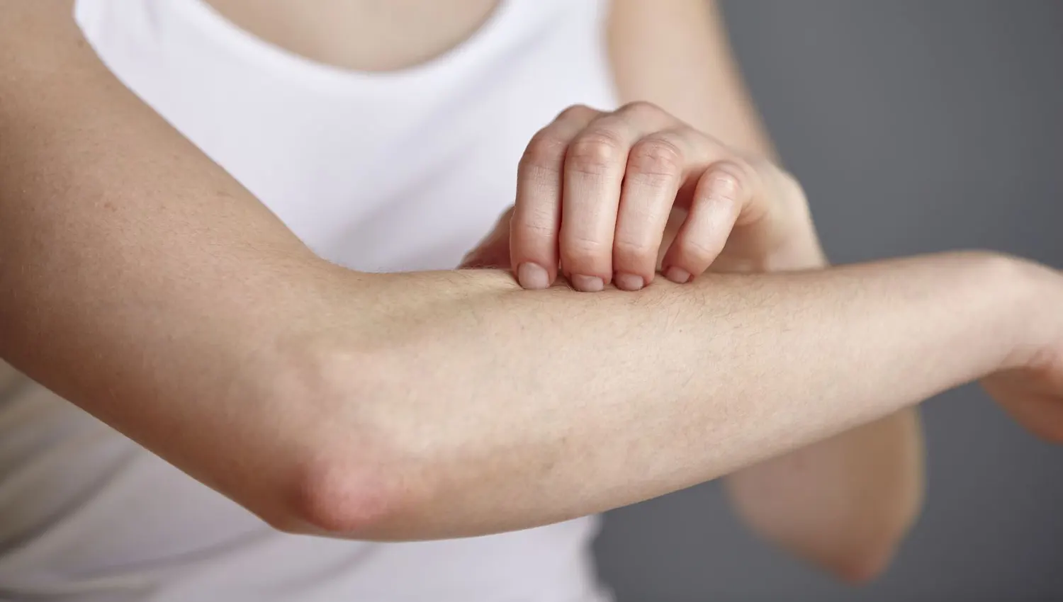 Da bị kích ứng nếu tiếp xúc trực tiếp với kali hydroxit